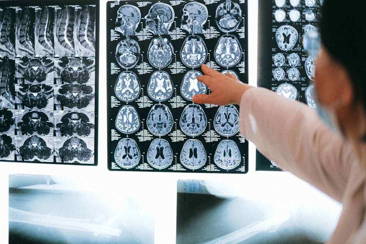 specializzazione in neurologia